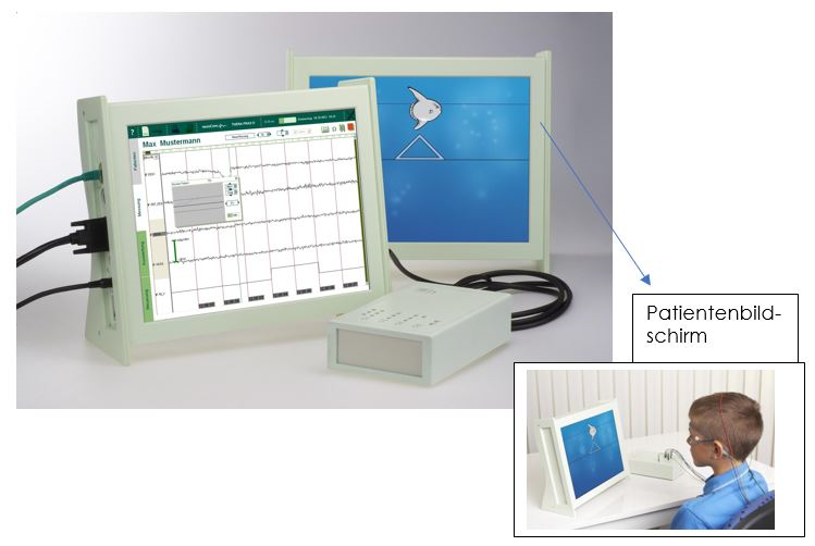 SCP-Neurofeedback Training