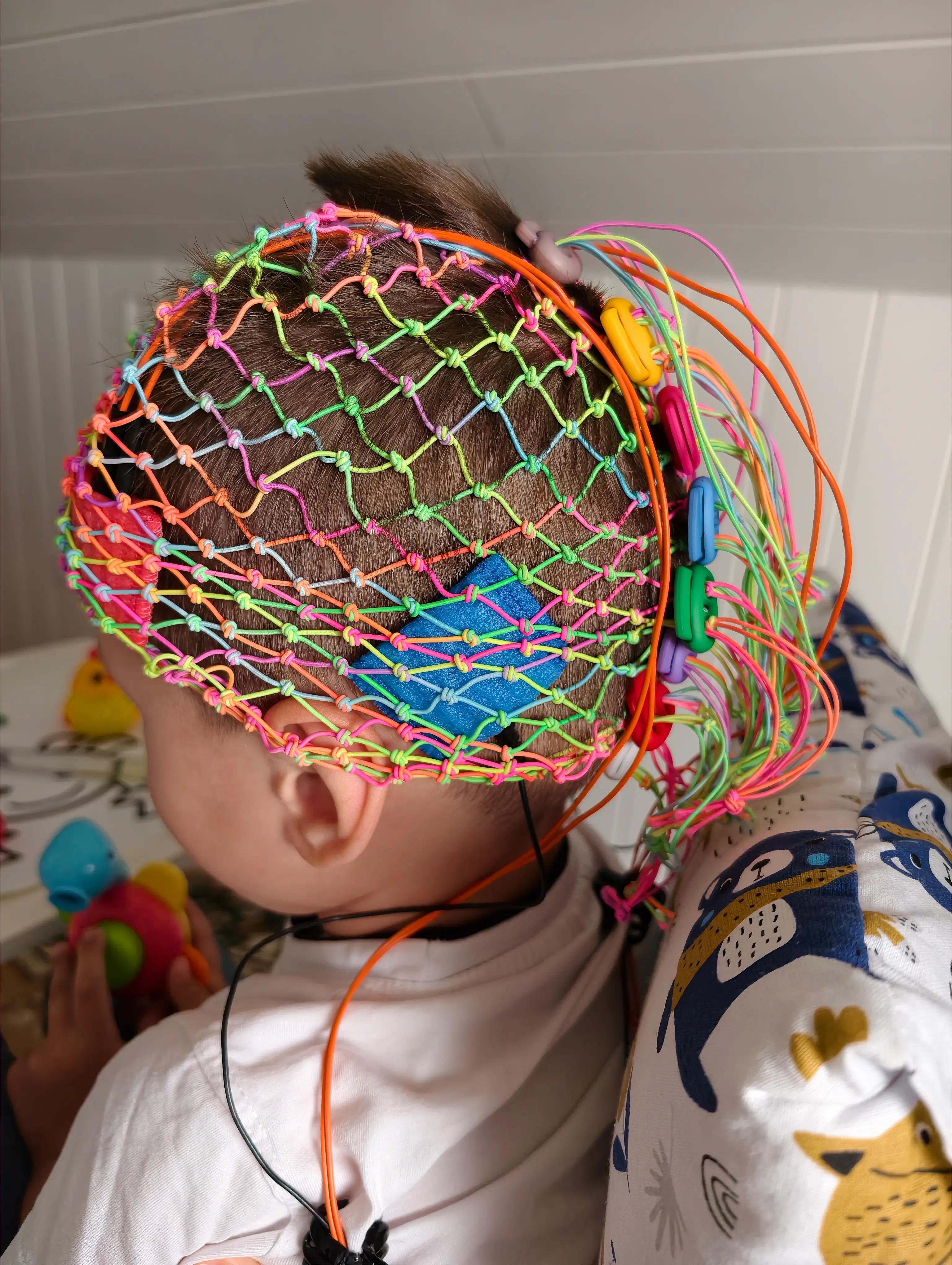 Off-Label-Use der tDCS-Therapie für Kinder in meiner Praxis